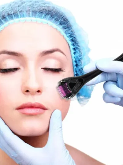 Derma Roller 0.5mm for Hair & Skin Therapy | 540 Titanium Micro-Needles